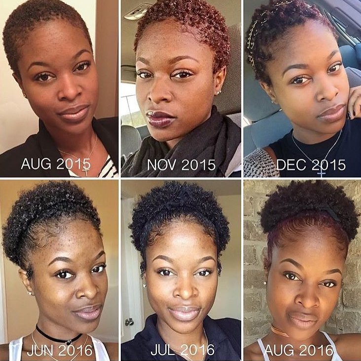 Castor Oil for Hair Growth: Benefits, Uses & How to Apply