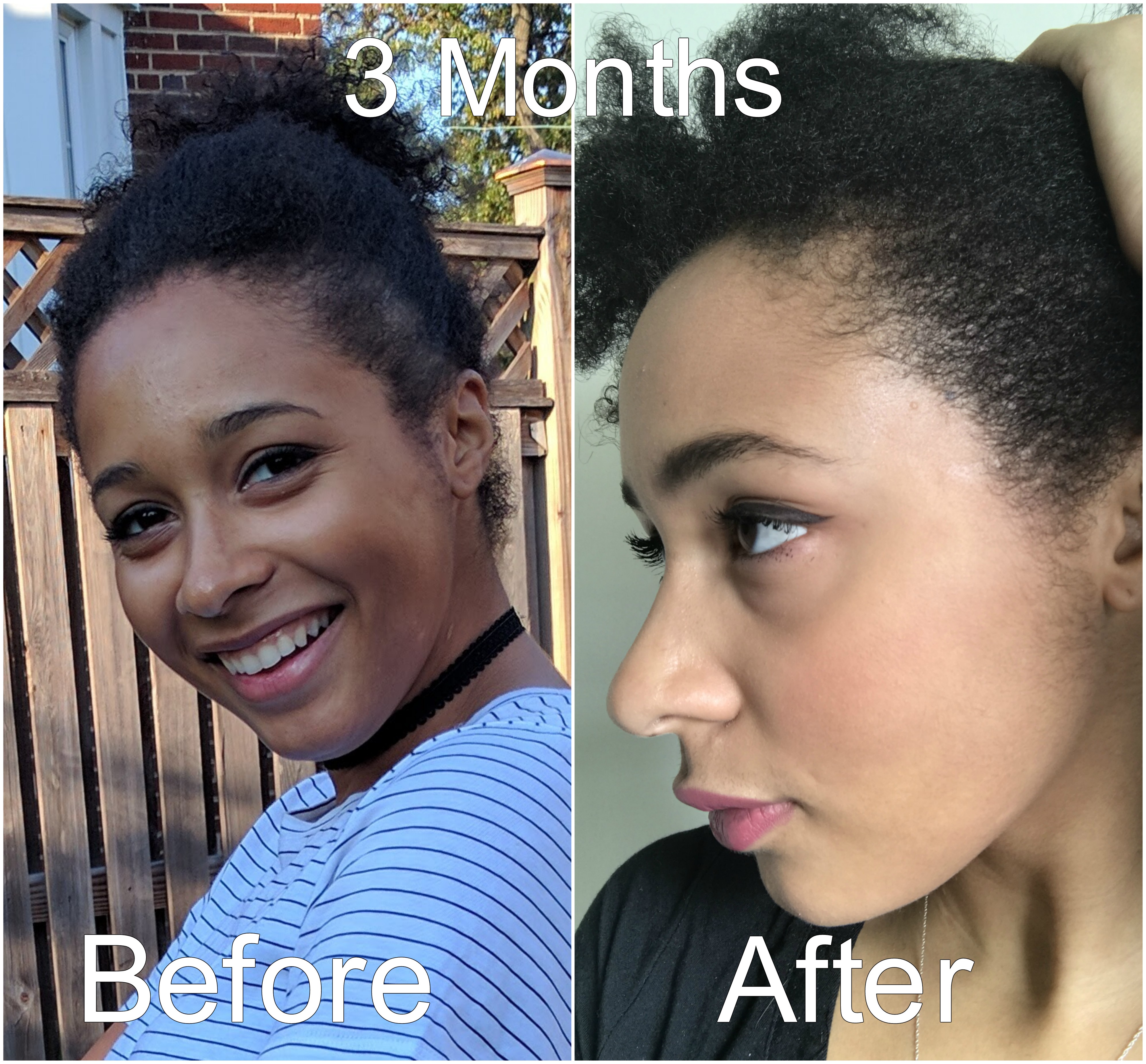 Jamaican Black Castor Oil: Deep Hydration for Curly & Kinky Hair