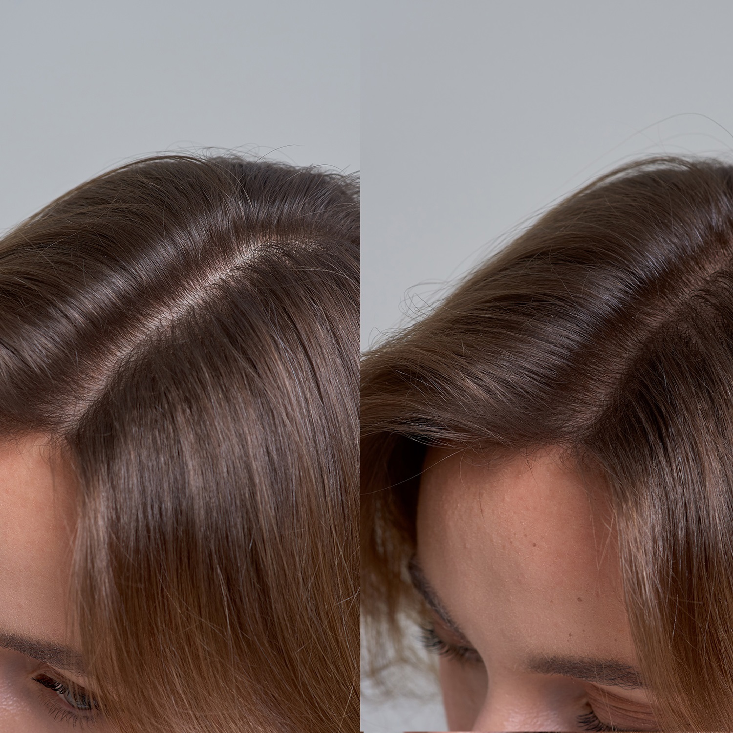 Boost Volume & Body: A Comprehensive Guide for Fine Hair