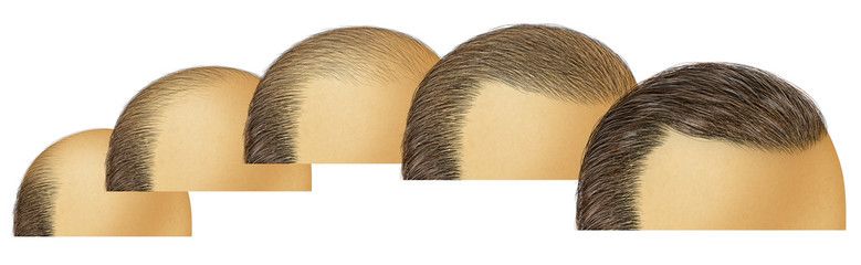 Ginger for Hair Growth: Benefits & Proven Results