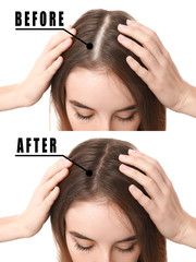 Avocado Leaves for Hair Growth: A Natural Remedy for Healthy Hair