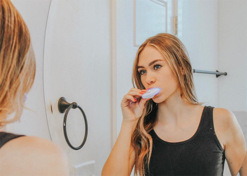 Top 15 At-Home Teeth Whitening Kits: Achieve a Brighter Smile