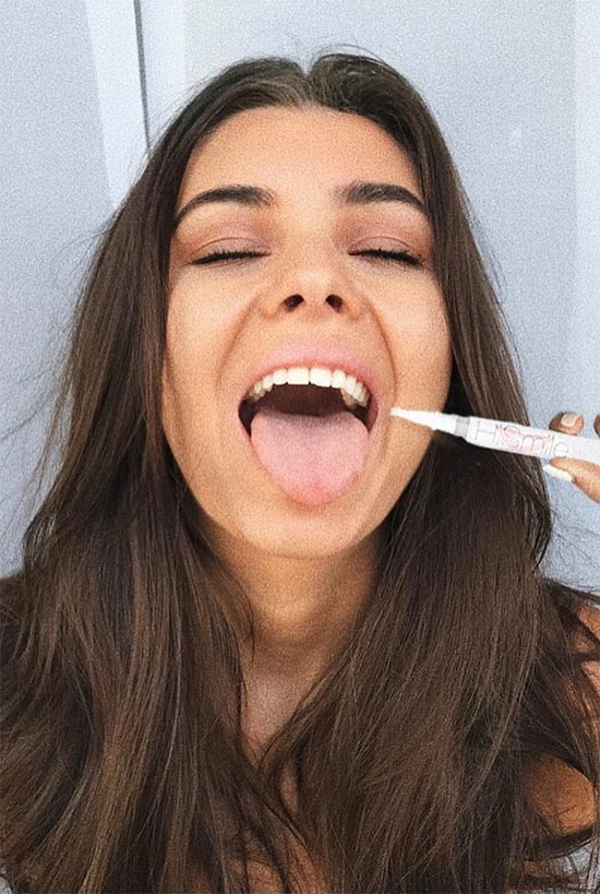 Top 15 At-Home Teeth Whitening Kits: Achieve a Brighter Smile