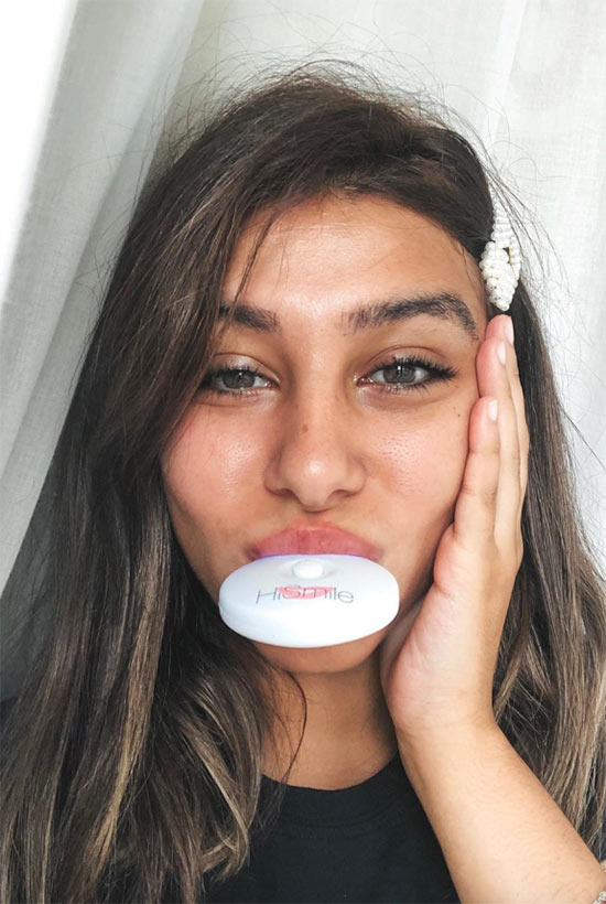 Top 15 At-Home Teeth Whitening Kits: Achieve a Brighter Smile