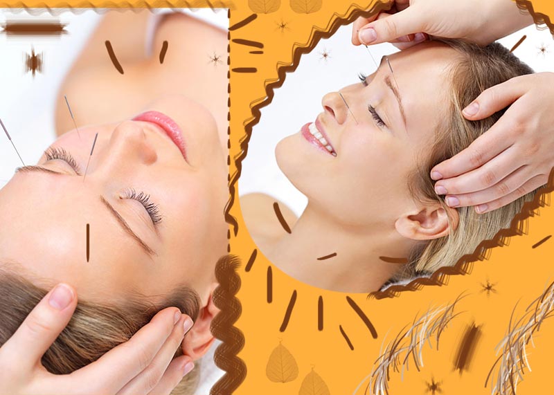 Cosmetic Acupuncture: Benefits, Costs & What to Expect