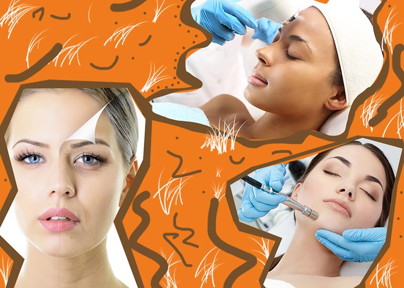 Microdermabrasion: Benefits, Procedure & Is It Right for Your Skin?