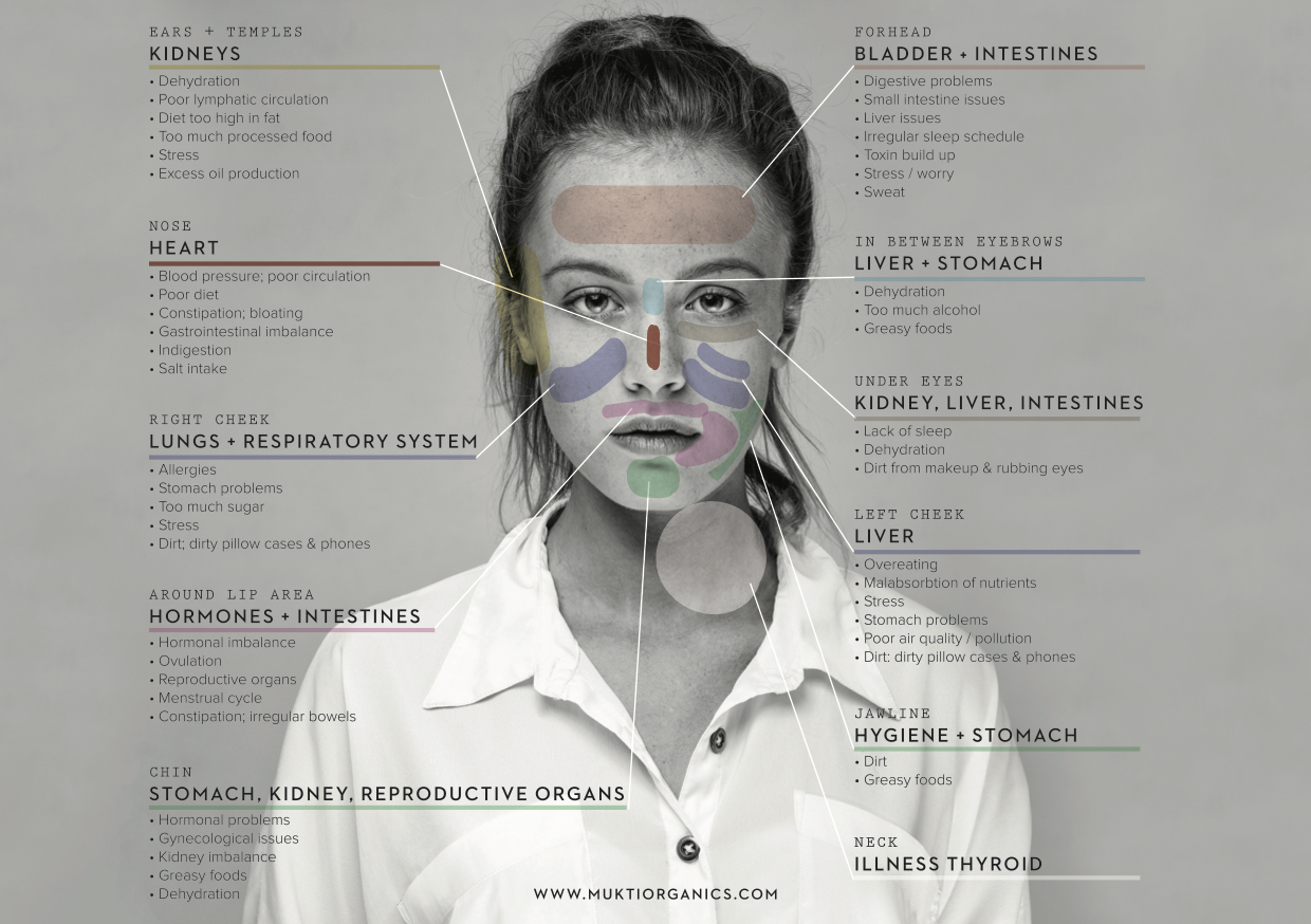 Face Mapping: Understanding & Preventing Breakouts - A Comprehensive Guide