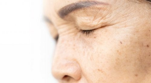 Natural Eyelid Lift: 4 Ingredients for Youthful Eyes