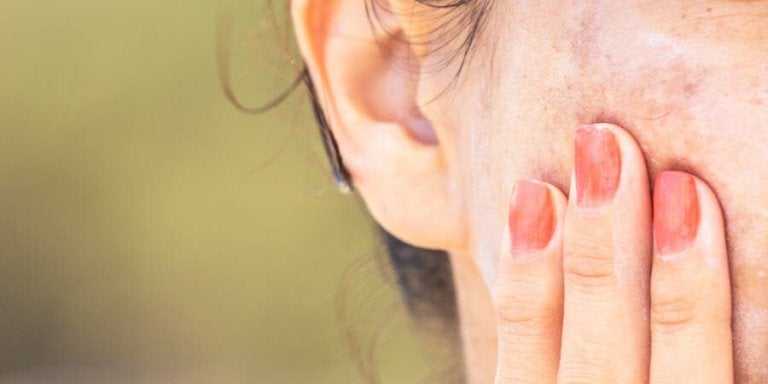Natural Ways to Fade Dark Spots & Even Skin Tone