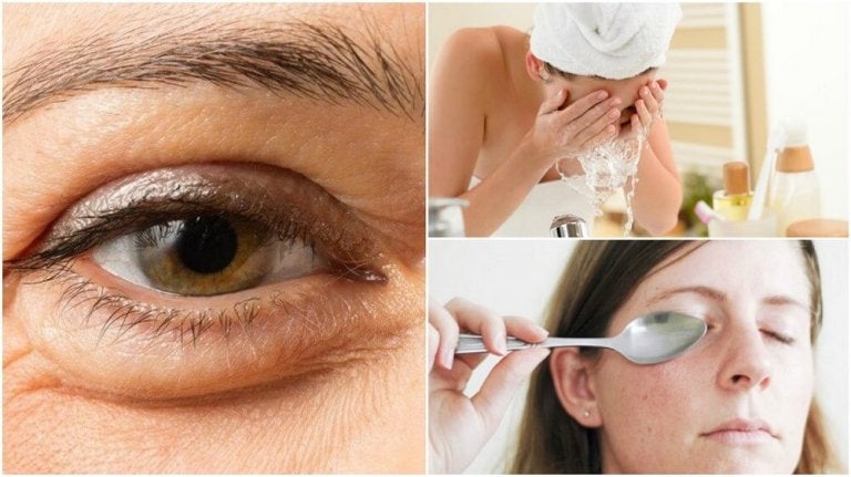 Effective Ways to Reduce Under-Eye Bags: Causes & Natural Remedies