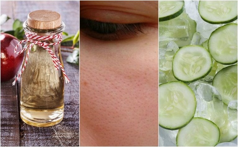 Minimize Pore Size Naturally: 6 Effective Methods