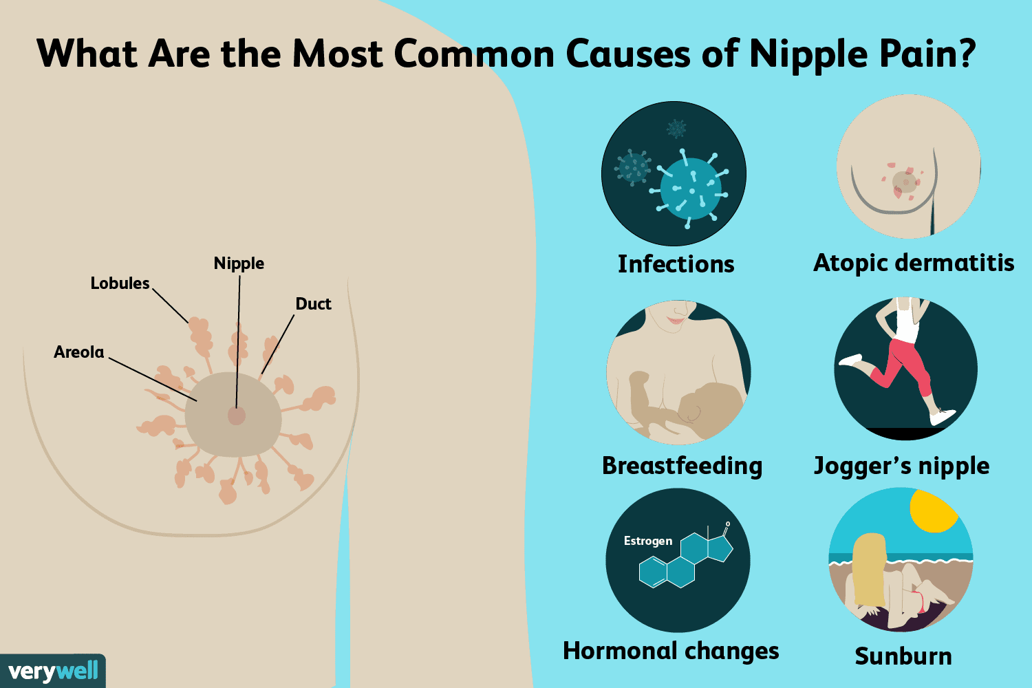 Nipple Pain: Causes, Symptoms & When to See a Doctor