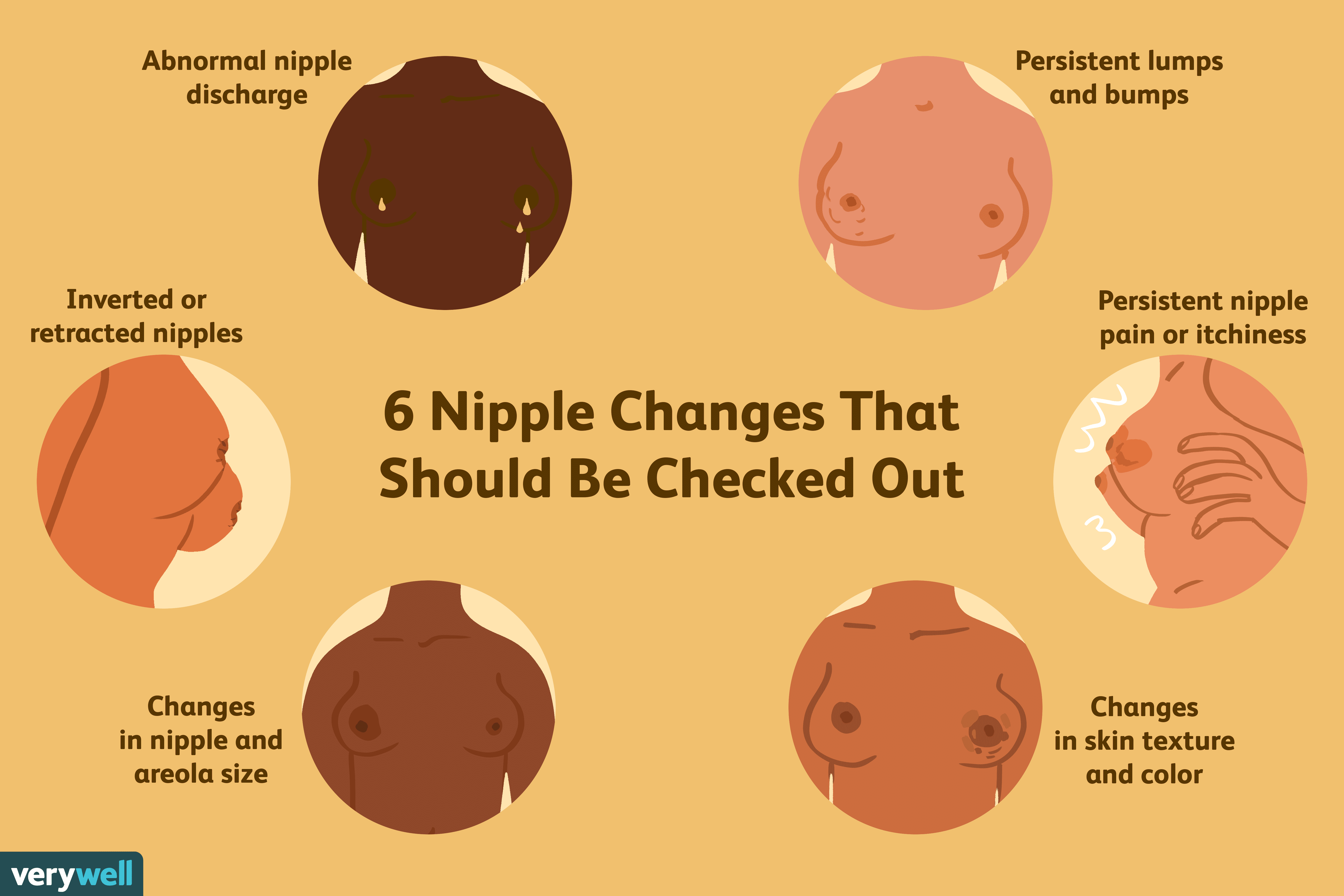 Nipple & Areola Changes: Understanding Normal vs. When to See a Doctor