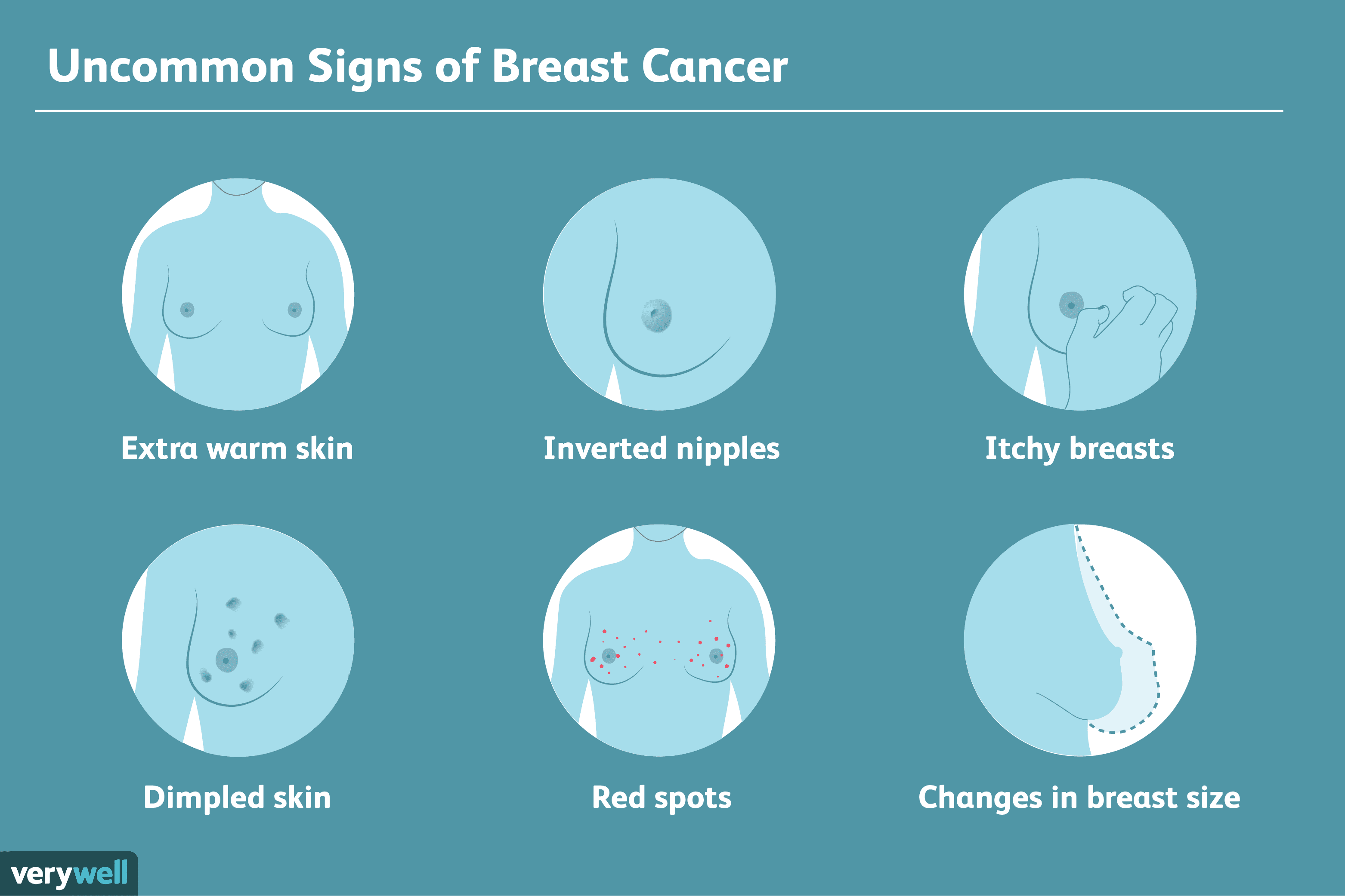 Beyond Lumps: 6 Uncommon Signs of Breast Cancer You Should Know