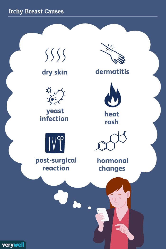 Understanding Itchy Breasts: Causes & When to Worry