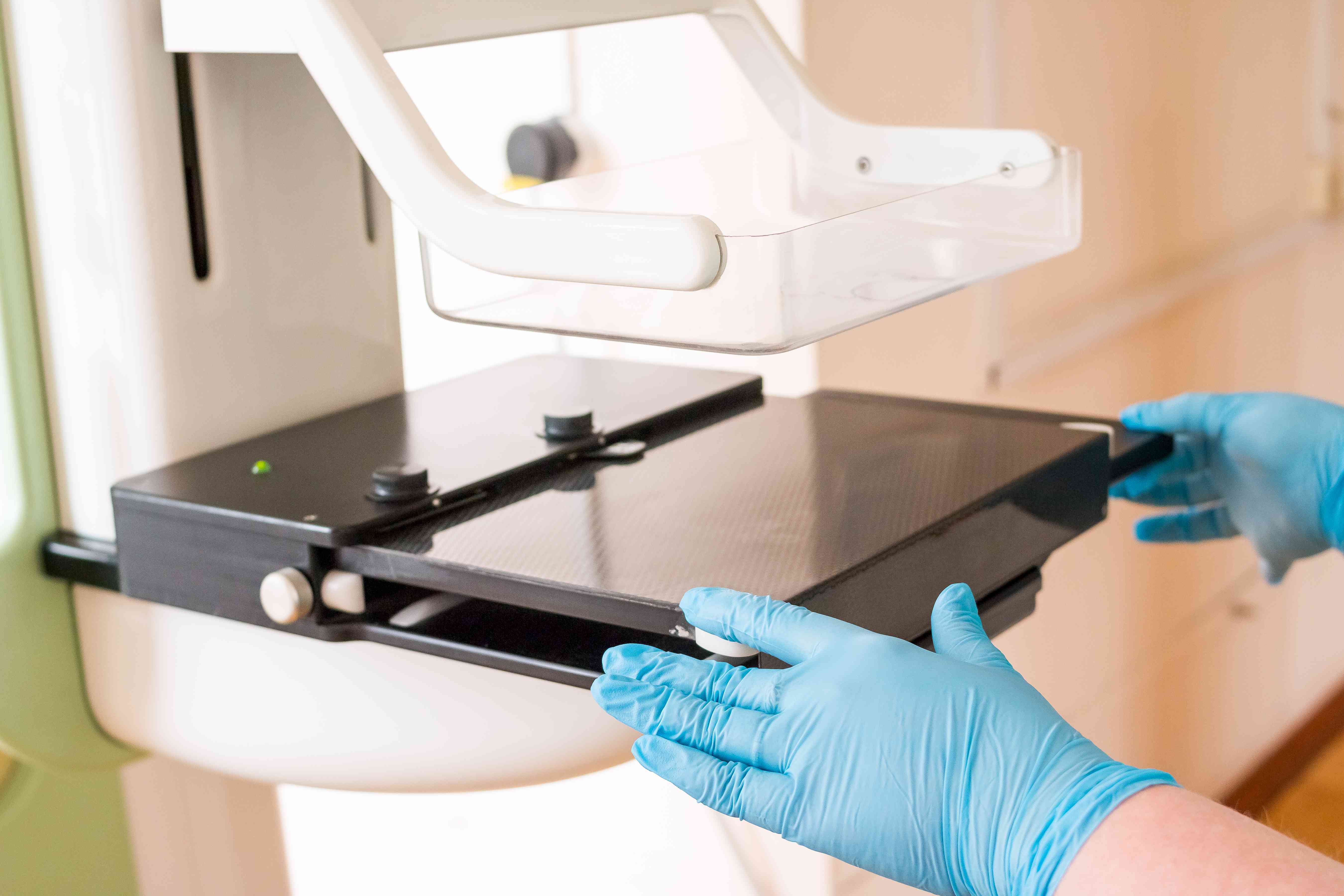 3D Mammogram: What It Is & What to Expect