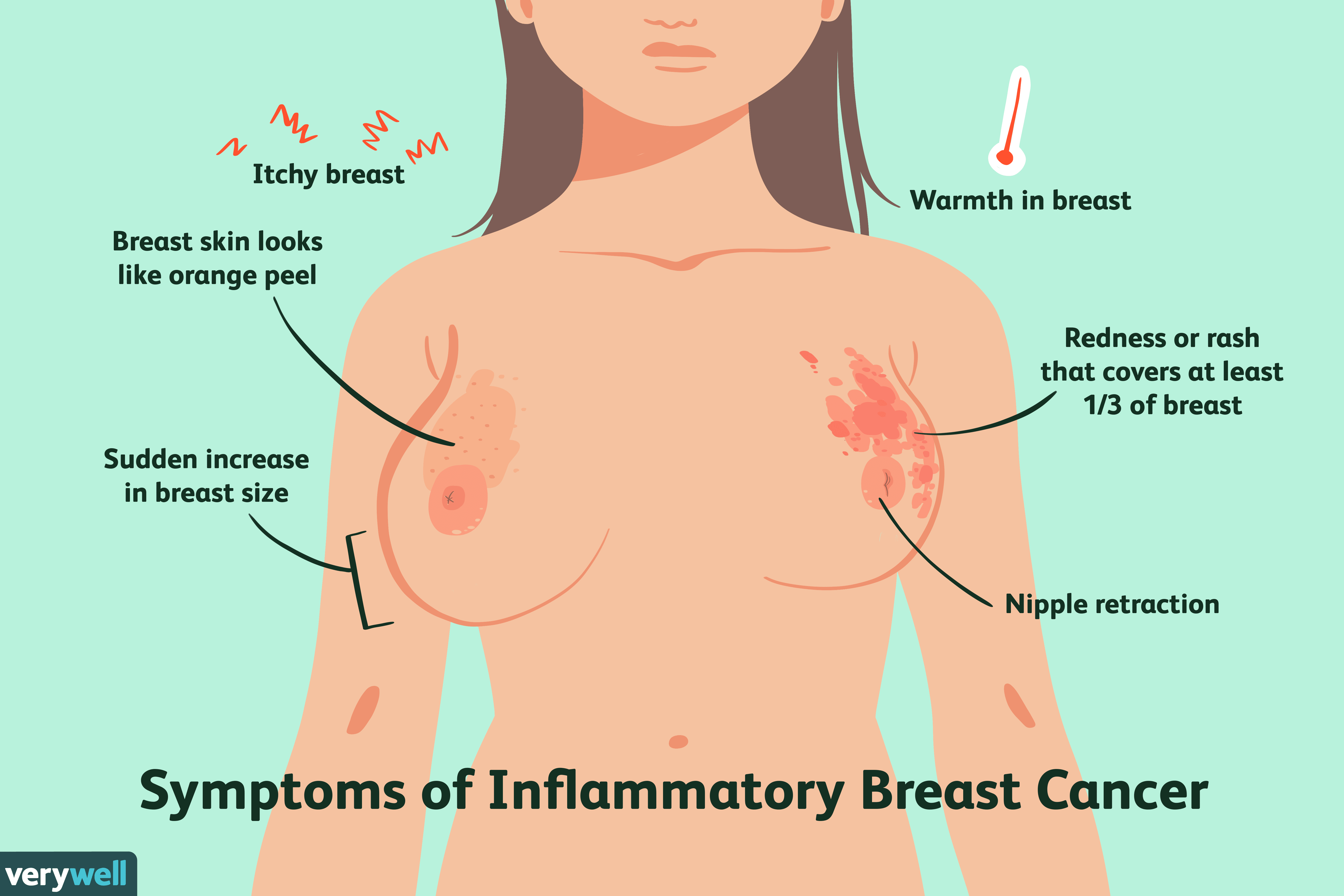 Understanding Breast Cancer Types: A Comprehensive Guide