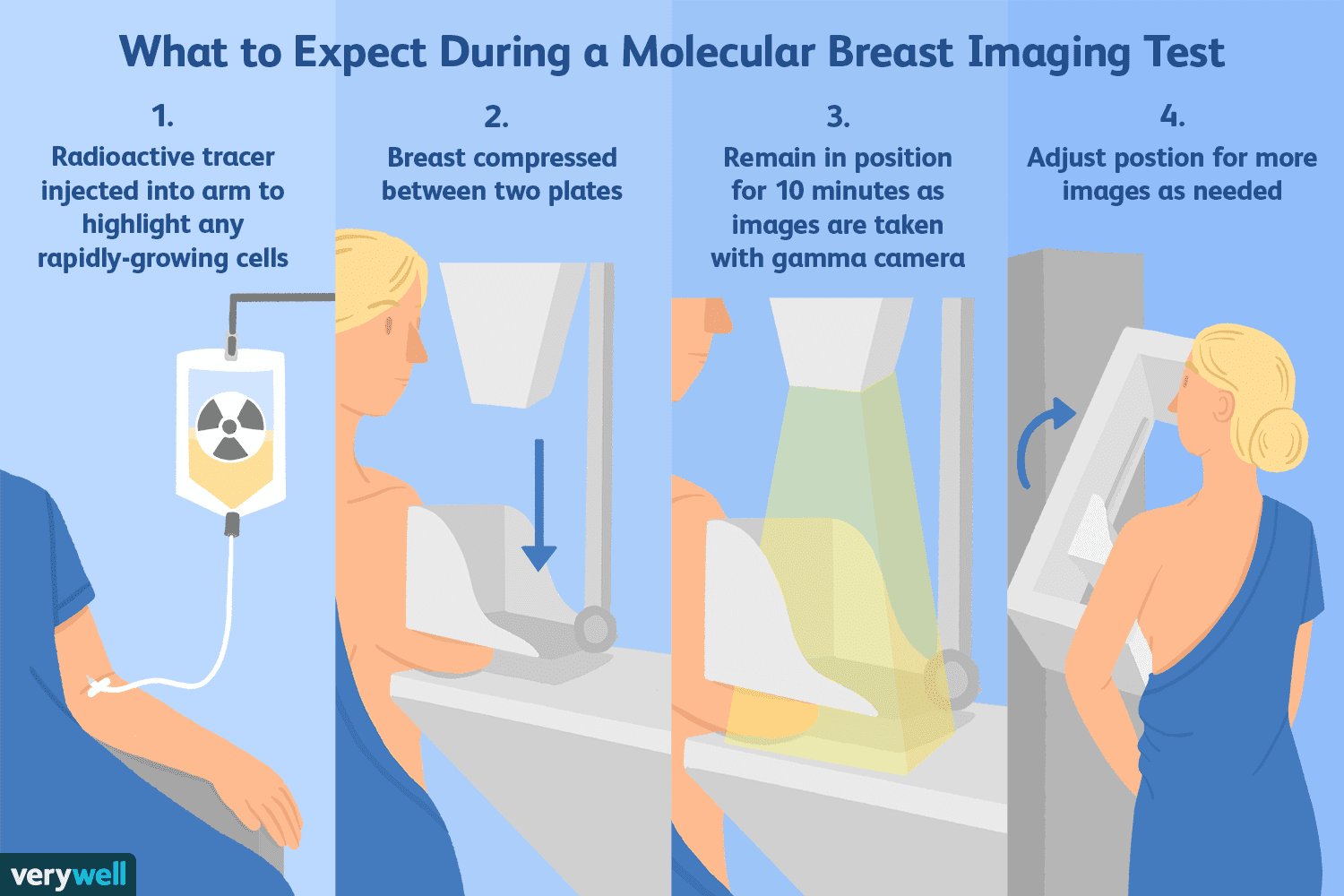 Molecular Breast Imaging (MBI): A Comprehensive Guide