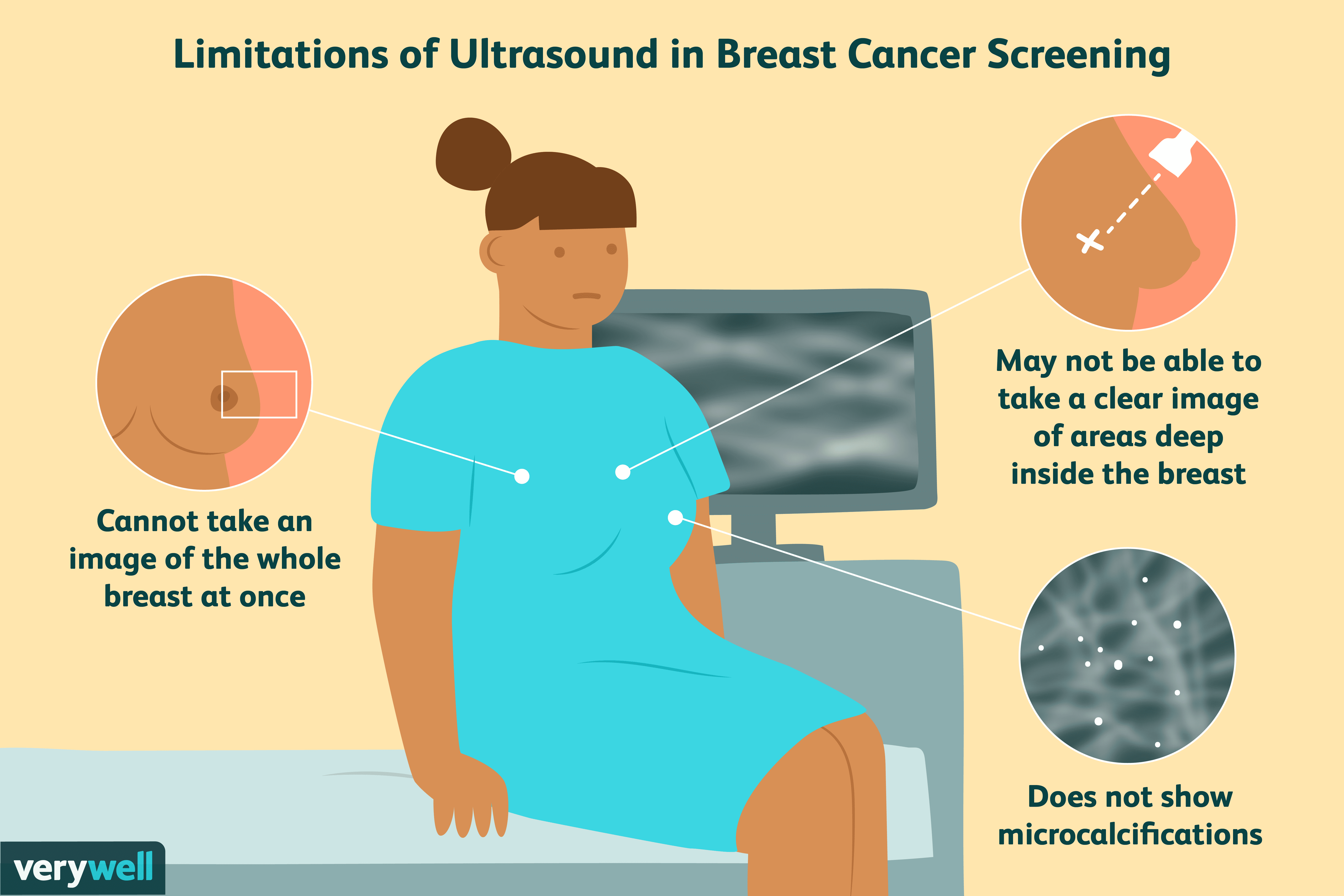 Mammograms vs. Ultrasounds: Which Breast Screening Method is Right for You?