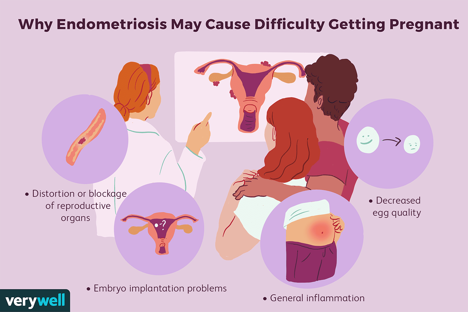Conceiving with Endometriosis: Strategies & Options