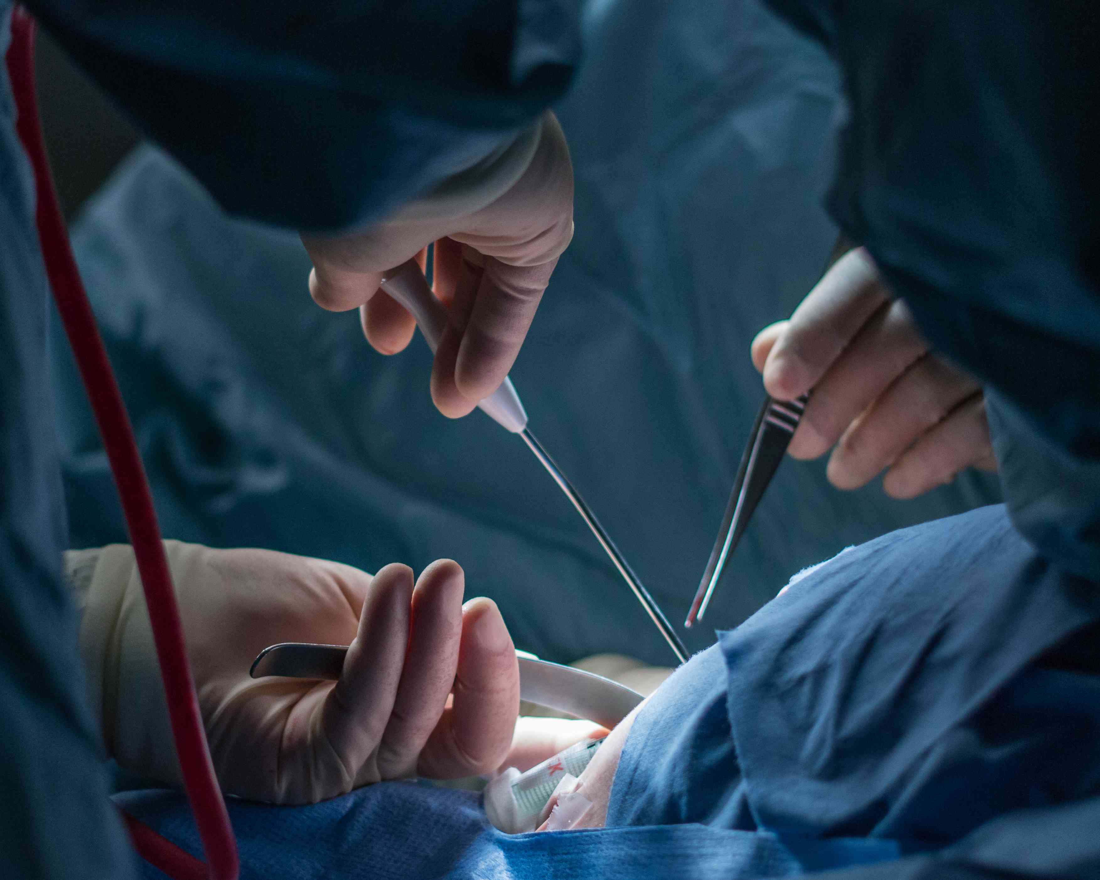 Bariatric Surgery for Heart Failure Prevention: A Viable Option?