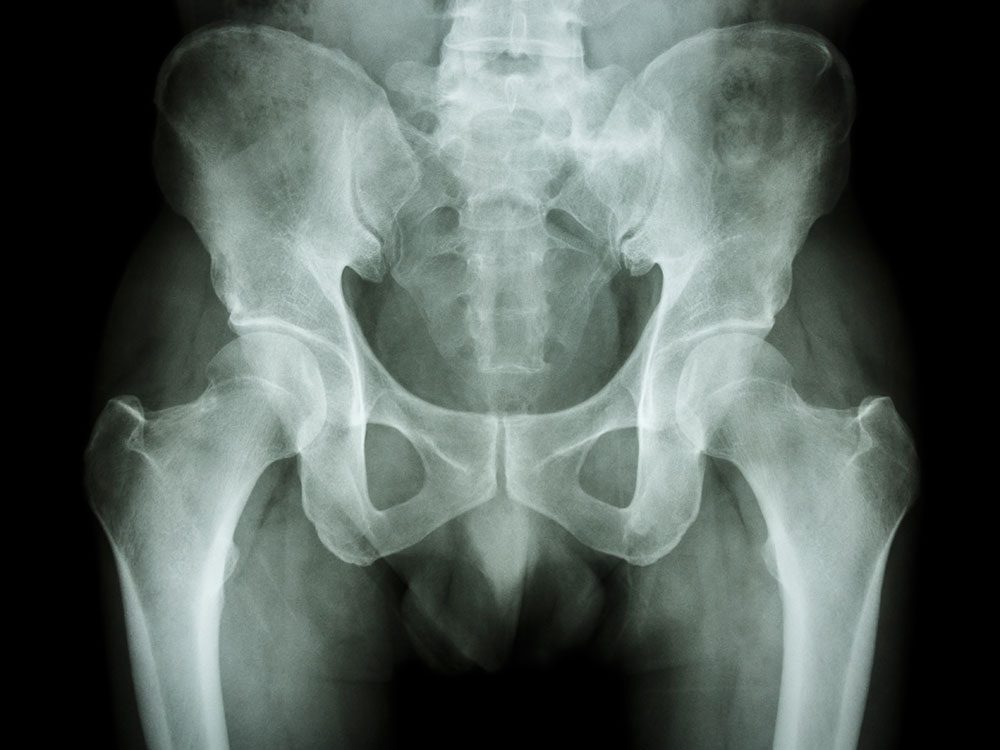 Milk s Health Benefits: A Comprehensive Look