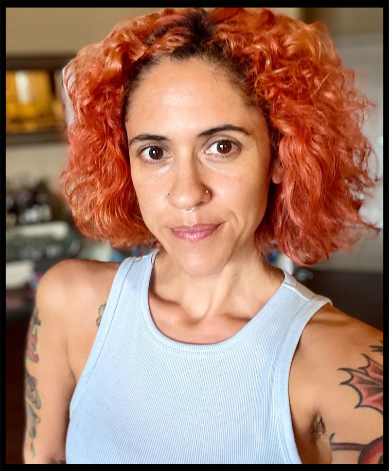 PRP for Dark Circles: A Personal Review & Results