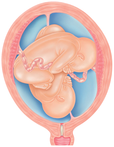 Preparing for a Twin Pregnancy: Essential Tips & Information