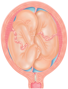 Preparing for a Twin Pregnancy: Essential Tips & Information