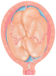 Preparing for a Twin Pregnancy: Essential Tips & Information