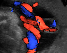 Understanding the Umbilical Cord: Function & Importance