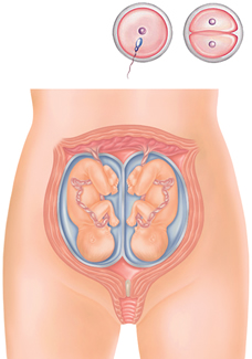 Understanding Twin Pregnancies: Types, Conception & Differences