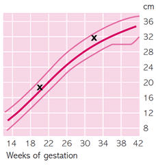 Understanding Fetal Growth: Charts & Monitoring