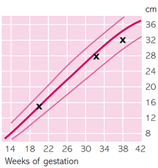 Understanding Fetal Growth: Charts & Monitoring