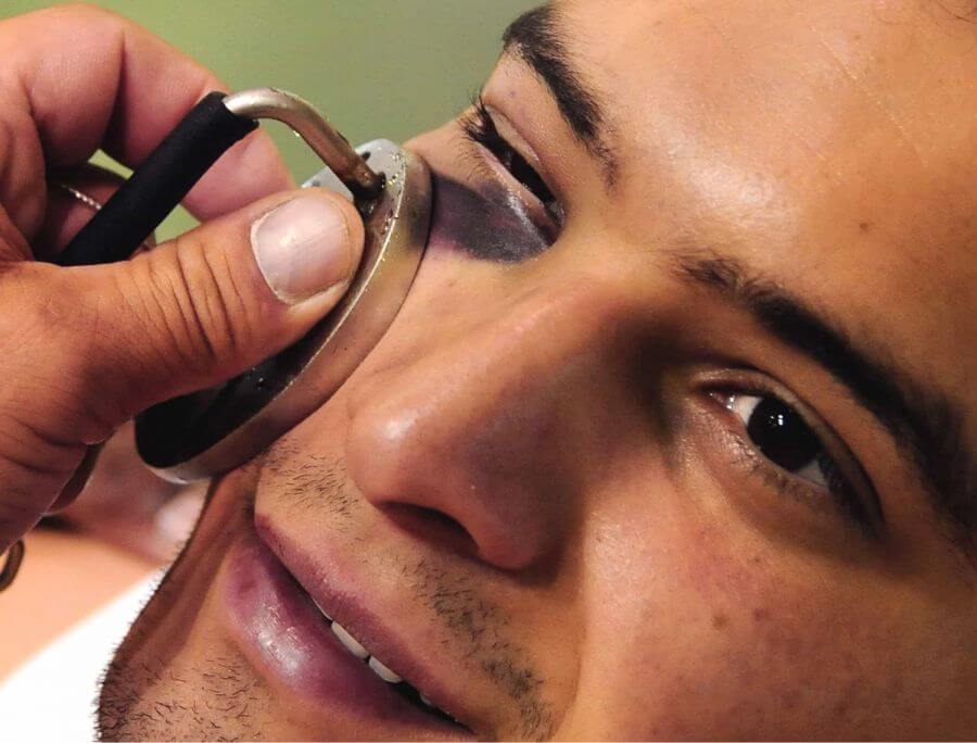 Effective Ways to Conceal and Reduce Under-Eye Bruises