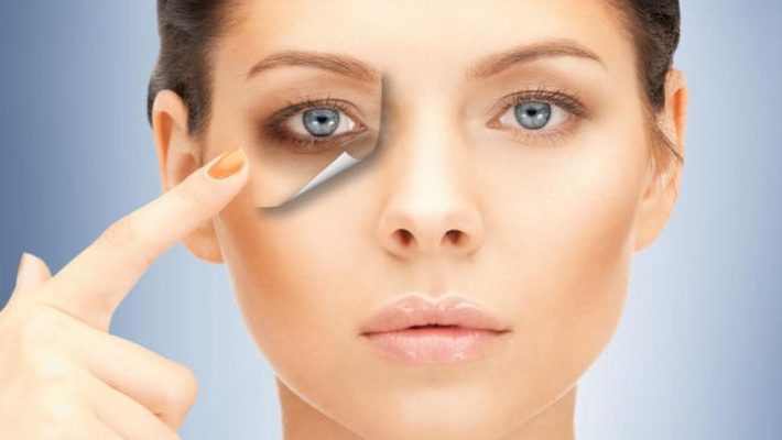 Effective Ways to Conceal and Reduce Under-Eye Bruises