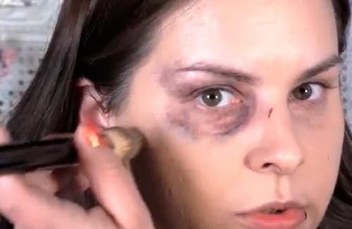 Effective Ways to Conceal and Reduce Under-Eye Bruises