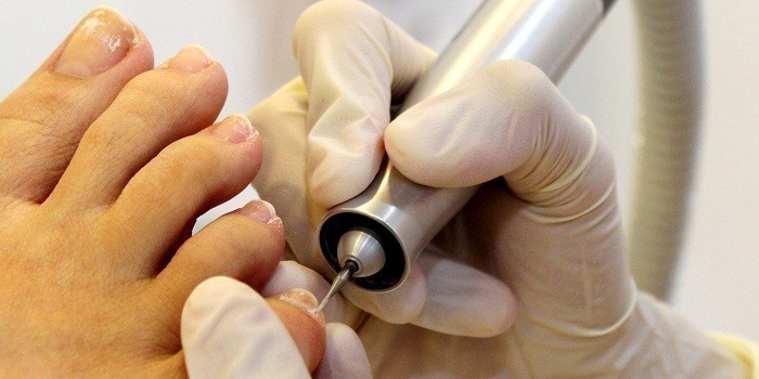 Nail Fungus from Manicures: Prevention & Treatment