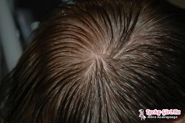 Understanding Oily Hair: Causes and Camphor Oil Mask Benefits