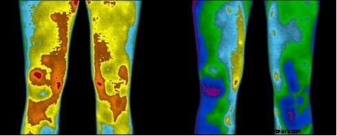 Earthing: Exploring the Science and Benefits of Grounding