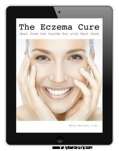 Understanding and Avoiding Eczema Triggers: A Holistic Approach