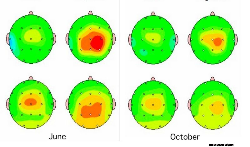 Neurofeedback Therapy: Enhance Focus, Creativity, Sleep & Reduce Stress | Harvard Insights