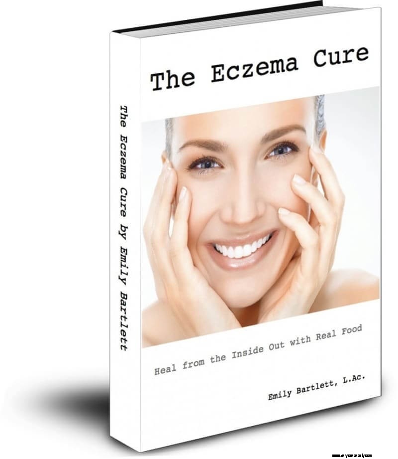 Understanding and Managing Eczema: A Personal Journey