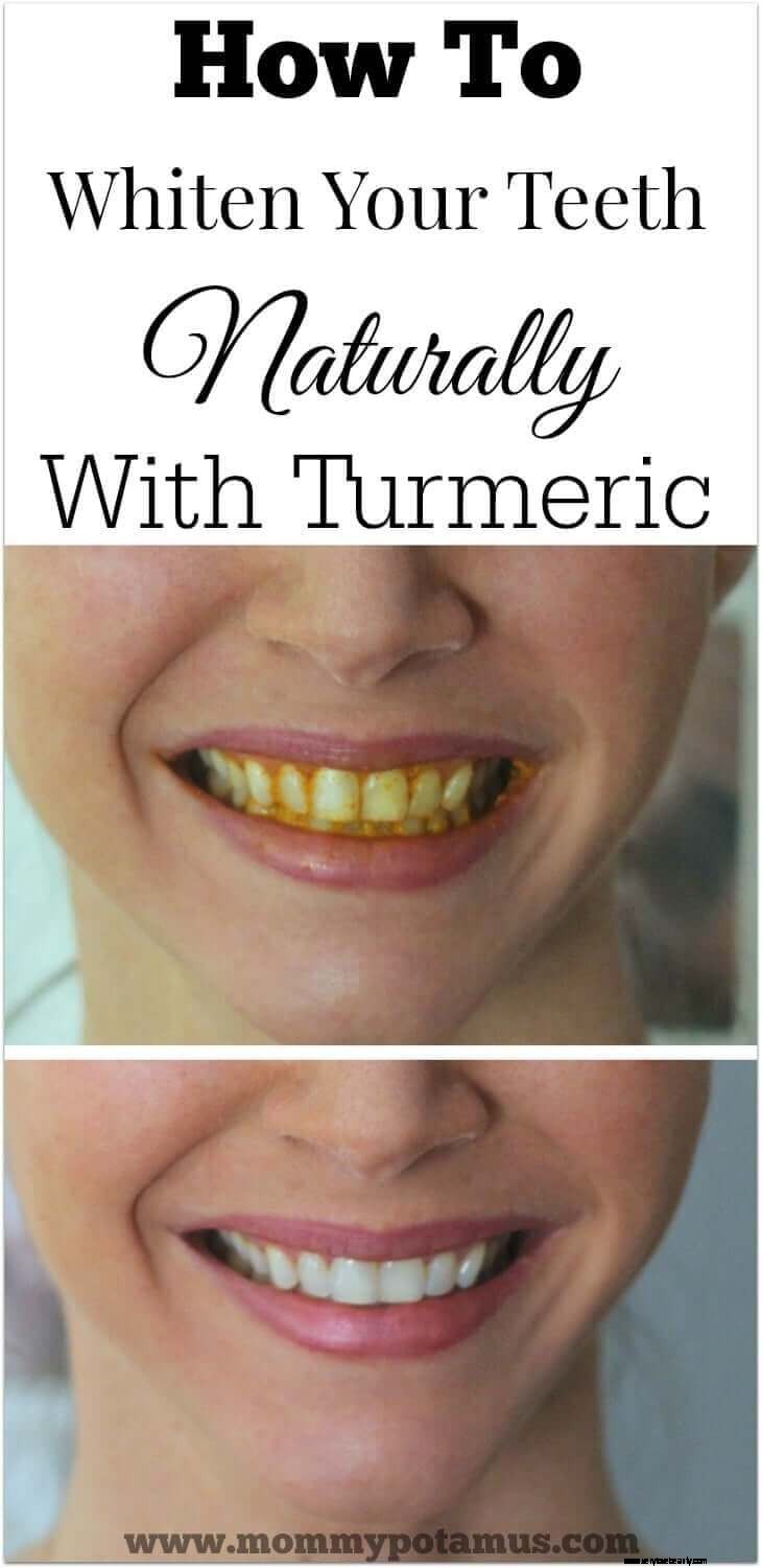 Natural Teeth Whitening with Turmeric: A Safe & Effective Guide