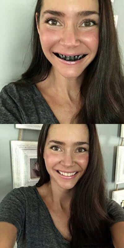 Naturally Whiten Teeth with Activated Charcoal: A Simple Guide