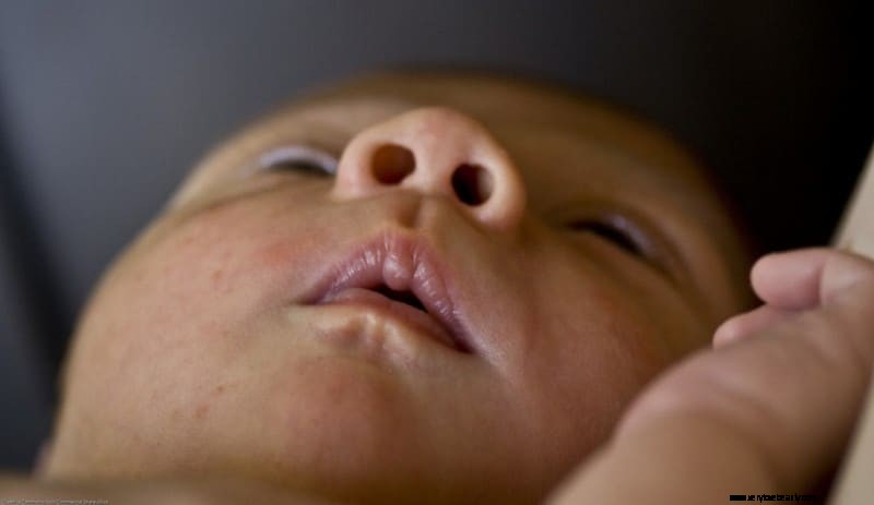 Tongue and Lip Tie Assessment: A Comprehensive Guide for Parents