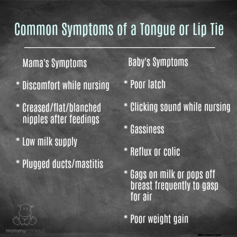 Tongue and Lip Tie Assessment: A Comprehensive Guide for Parents