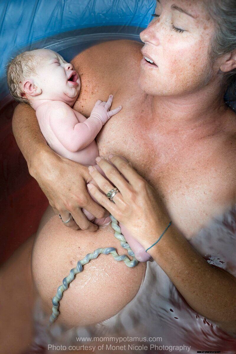 Delayed Cord Clamping: Benefits & What You Need to Know