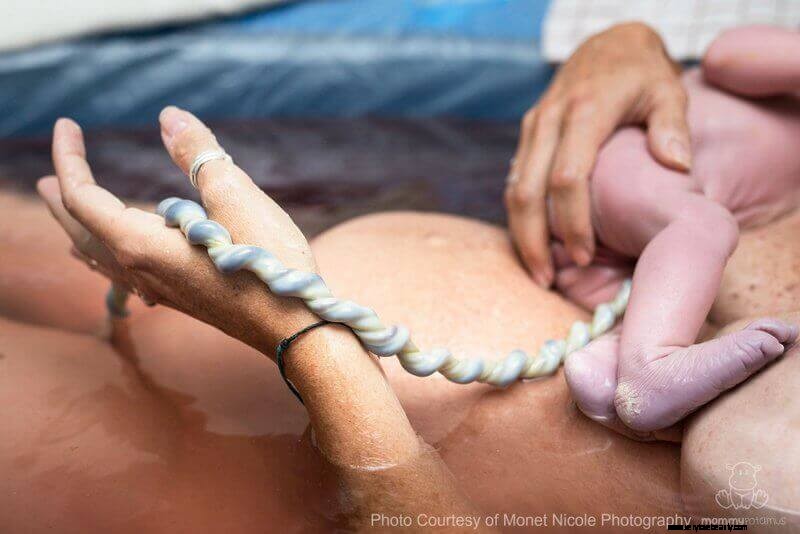Delayed Cord Clamping: Benefits & What You Need to Know