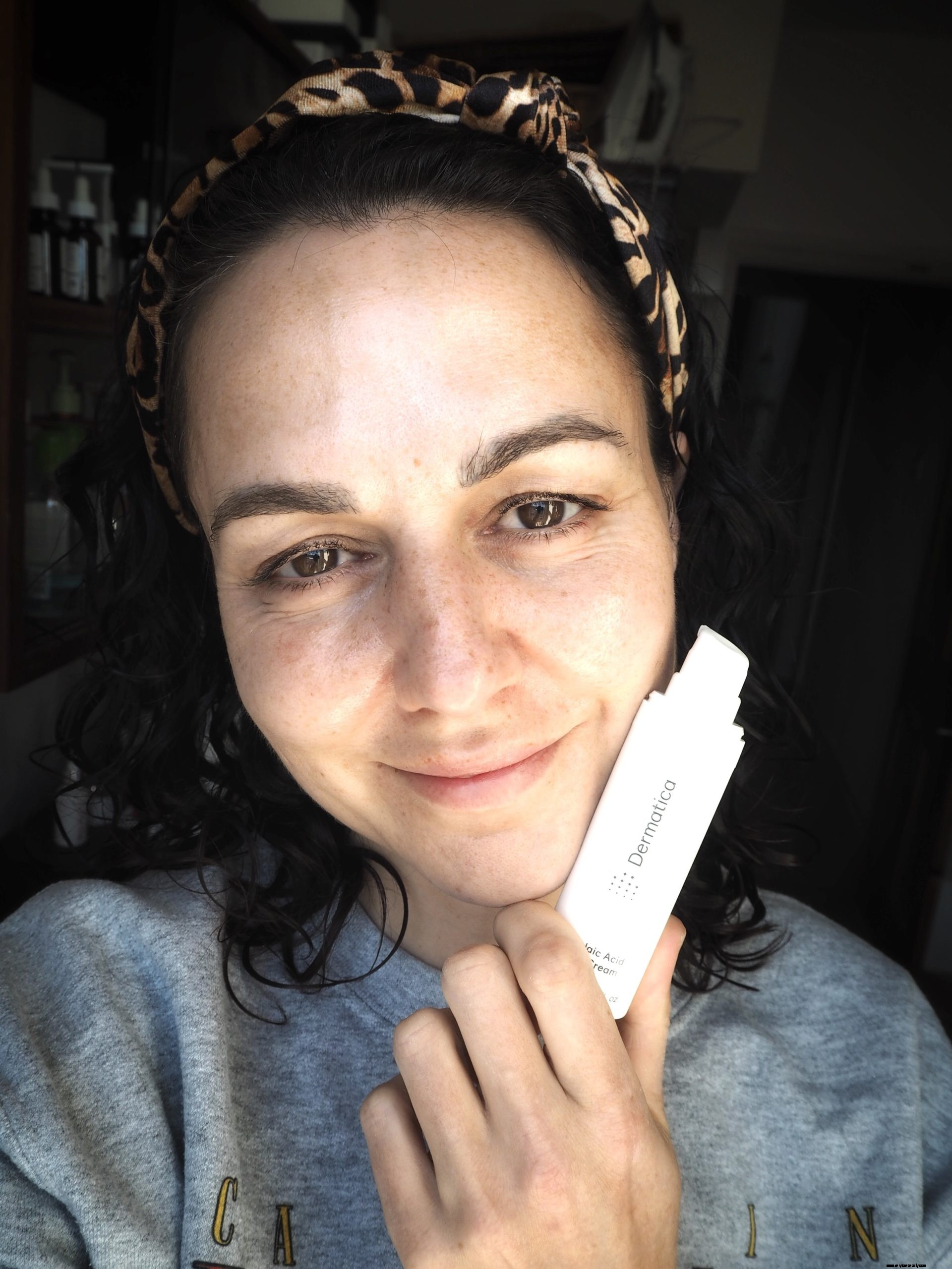 Dermatica 20% Azelaic Acid Cream Review: UK Acne Treatment - No Prescription Needed!